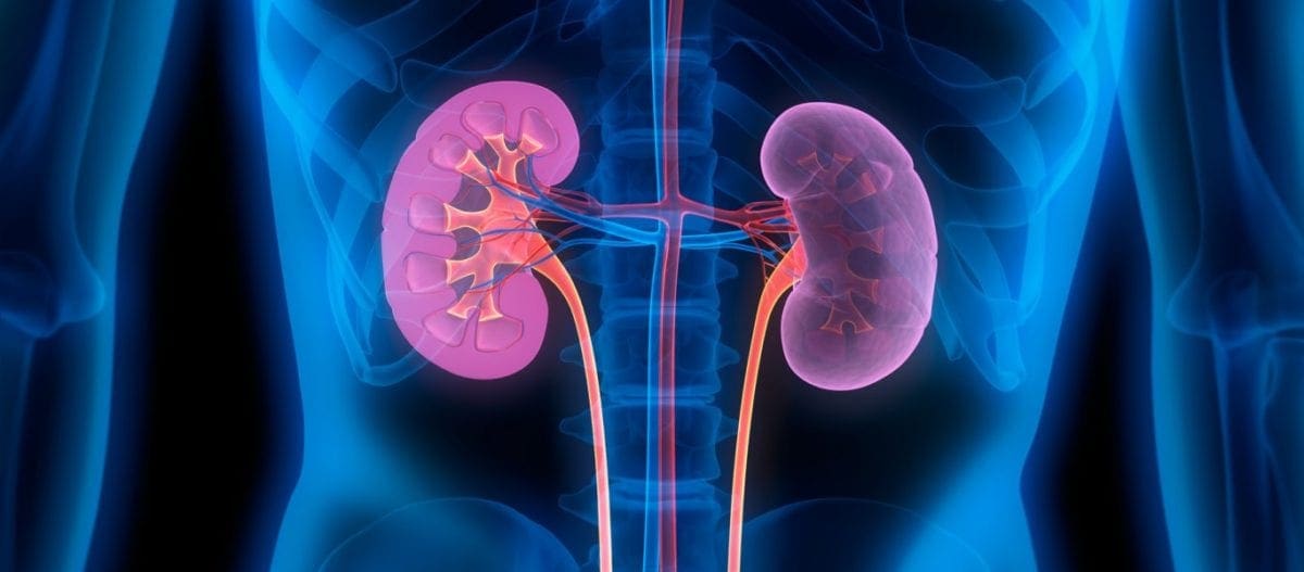 Πέτρες στα νεφρά