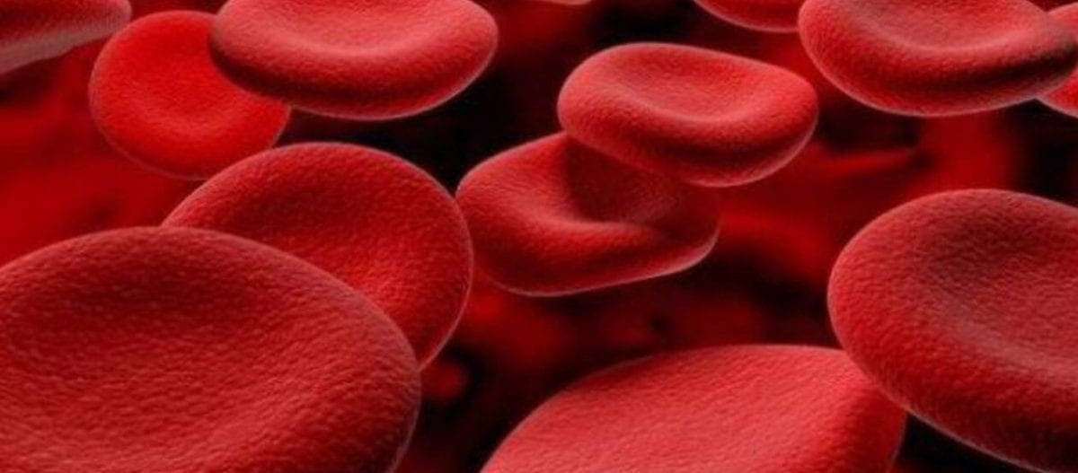 Αιμοχρωμάτωση