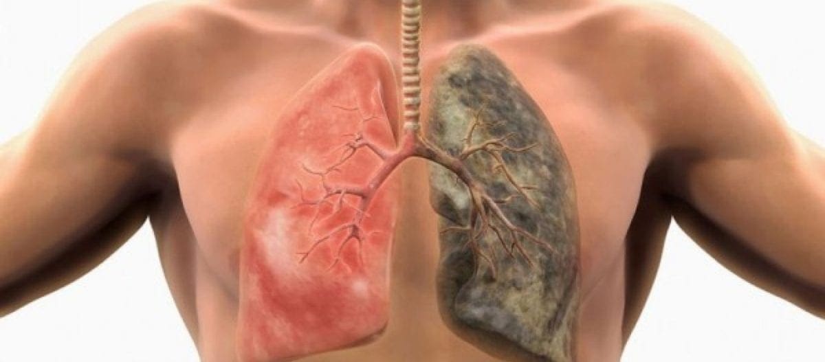 Τροφές που καθαρίζουν τα πνευμόνια από το τσιγάρο