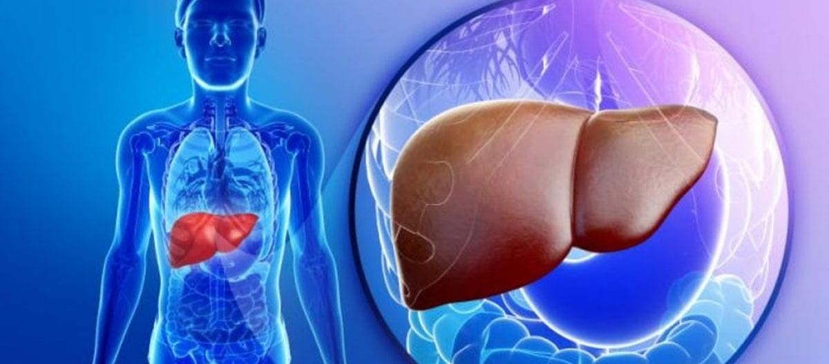 Λιπώδες ήπαρ