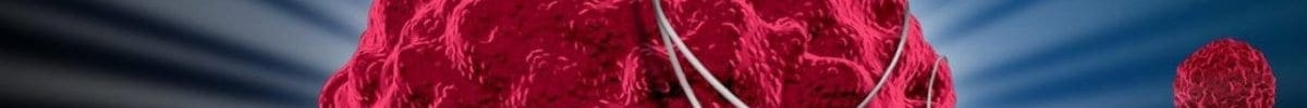 Οι καρκινοπαθείς που αποφεύγουν τη ζάχαρη έχουν πάνω από το διπλάσιο ποσοστό επιβίωσης (90%)